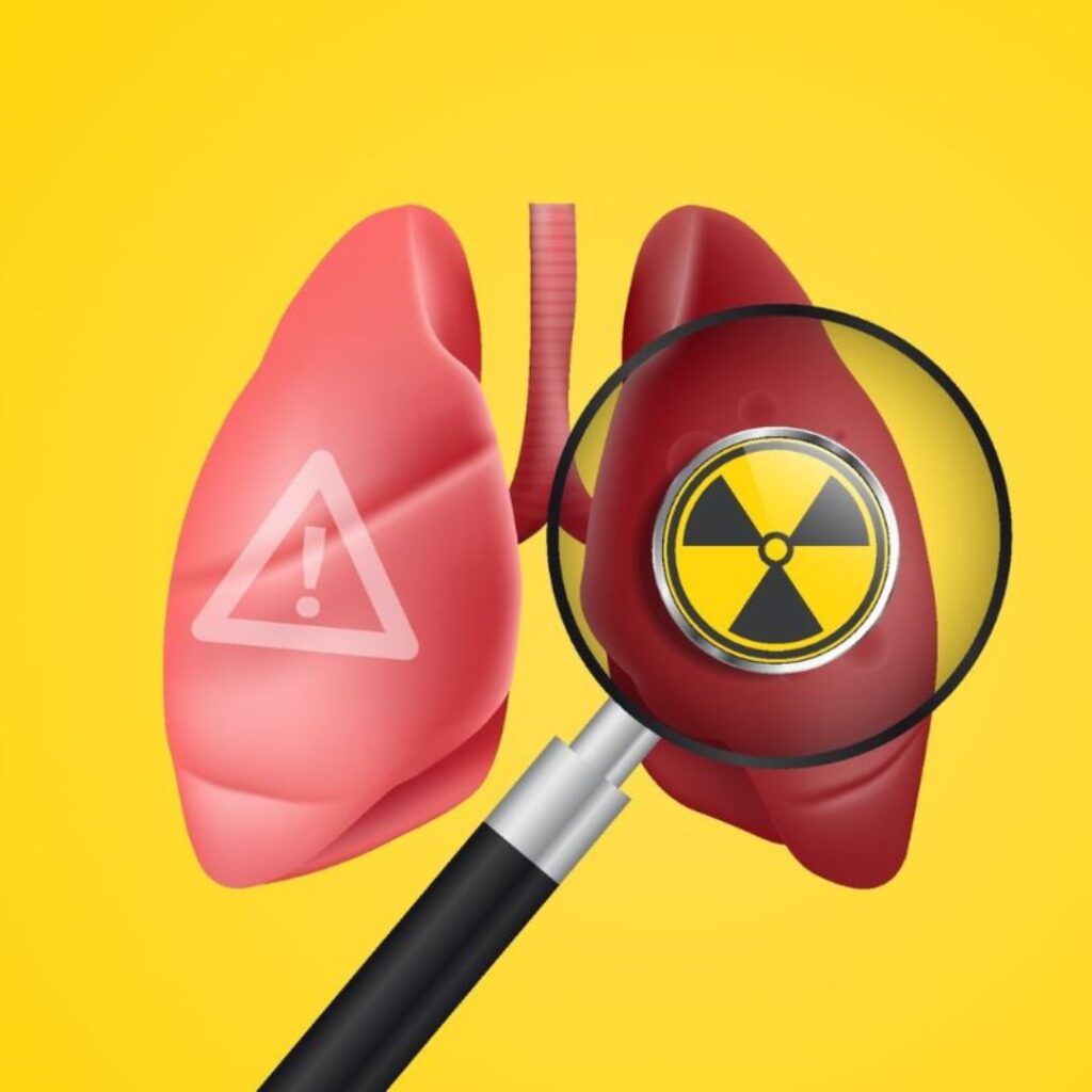 Cáncer de pulmón y gas radón.